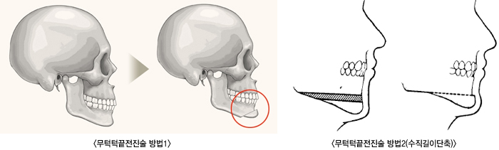 �γ����������1/�γ����������2(�������̴���)