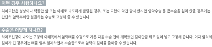 � ��� �����ϳ���?/������ ��� �ϳ���? 