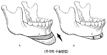 �ְ��μ������