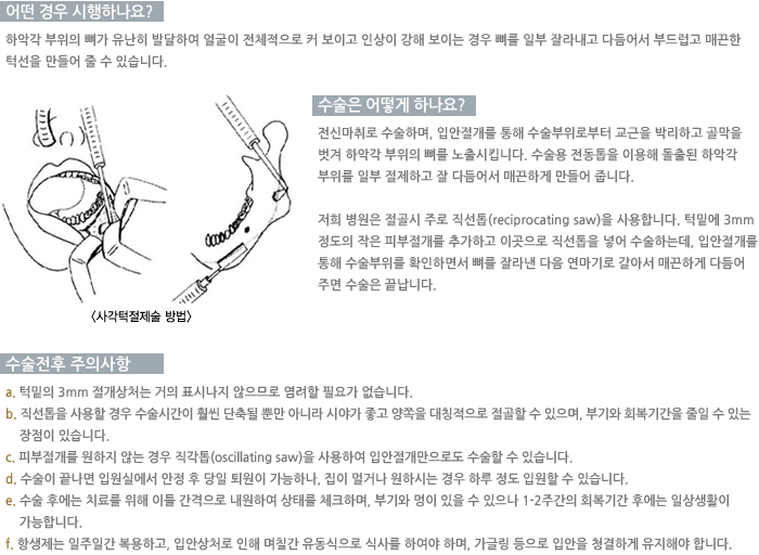 �簢�����������/� ��� �����ϳ���?/������ ��� �ϳ���?/�������� ���ǻ��� 