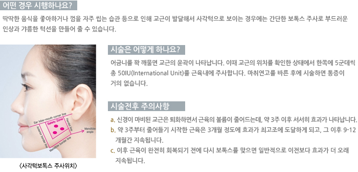 �簢�κ��彺�ֻ���ġ/� ��� �����ϳ���?/�ü��� ��� �ϳ���?/�ü����� ���ǻ��� 