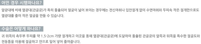 � ��� �����ϳ���?/������ ��� �ϳ���?