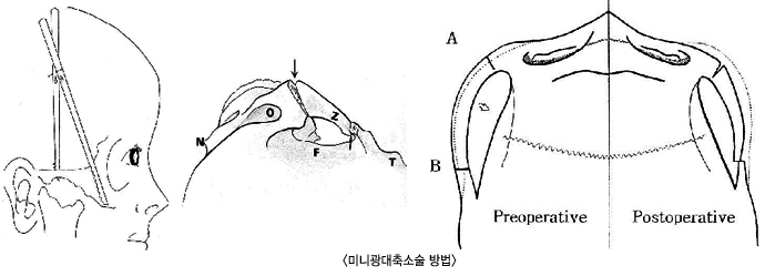 �̴ϱ�����Ҽ����1/�̴ϱ�����Ҽ����2