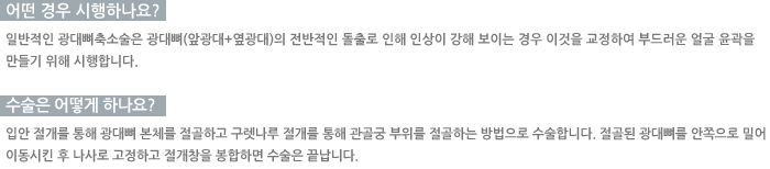 � ��� �����ϳ���?/������ ��� �ϳ���?