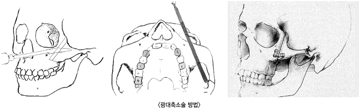 ������Ҽ����1/������Ҽ����2