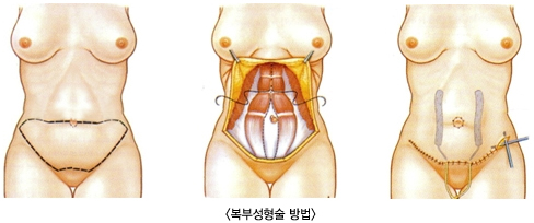 ���μ��������1,2,3