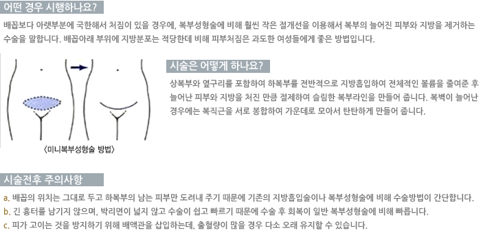 �̴Ϻ��μ��������/� ��� �����ϳ���?/������ ��� �ϳ���?/�������� ���ǻ���