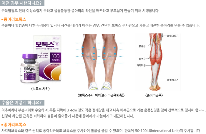 � ��� �����ϳ���?/������ ��� �ϳ���?