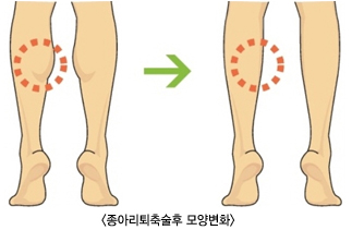 ���Ƹ�������� ��纯ȭ