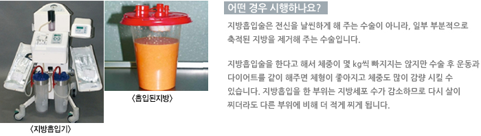 �������Ա�/���ε�����/� ��� �����ϳ���?