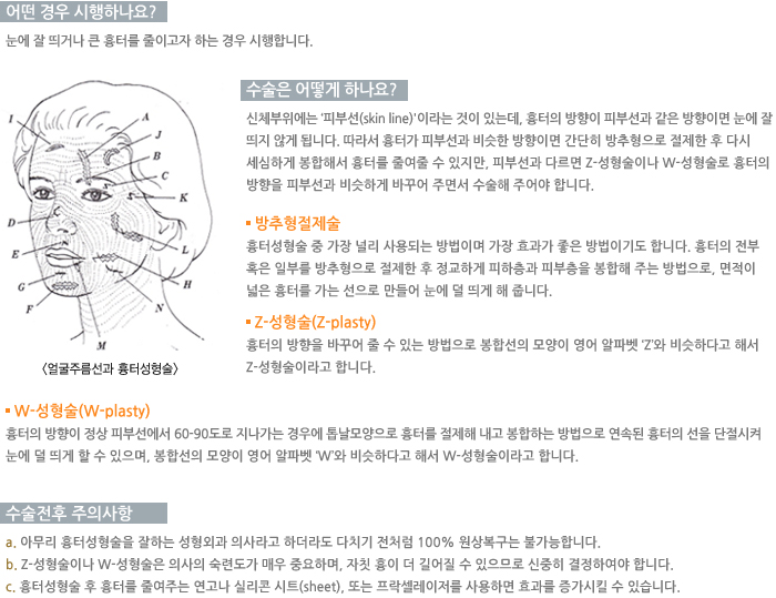 � ��� �����ϳ���?/������ ��� �ϳ���? /�������� ���ǻ���