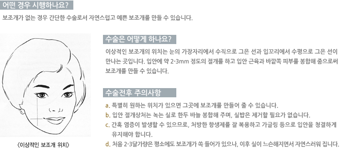 � ��� �����ϳ���?/������ ��� �ϳ���? /�������� ���ǻ���