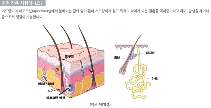 � ��� �����ϳ���?/����ũ������