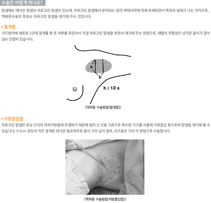 ������ ��� �ϳ���?/������/�������Թ�