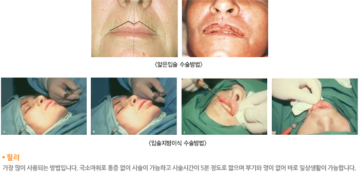 �����Լ� �������/�Լ������̽� �������