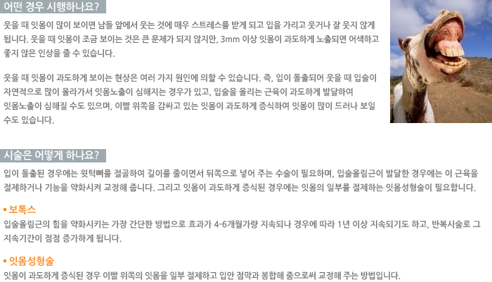 � ��� �����ϳ���?/�ü��� ��� �ϳ���? /