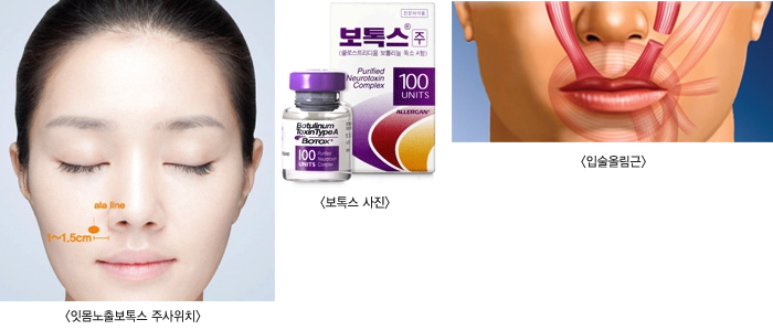 �ո����⺸�彺�ֻ���ġ/���彺����/�Լ��ø���