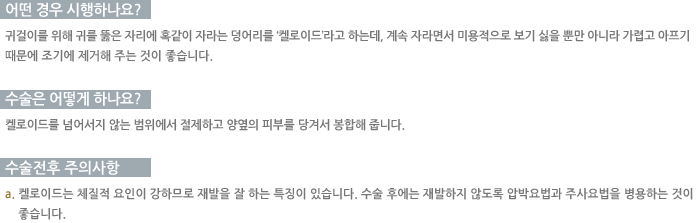 � ��� �����ϳ���?/������ ��� �ϳ���? /�������� ���ǻ���