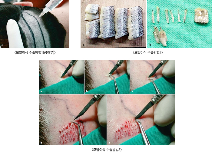 ����̽� �������