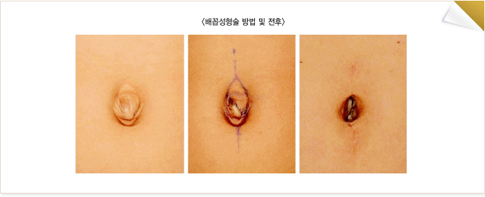 ��ż���������� �������