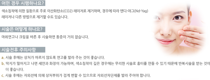 � ��� �����ϳ���?/�ü��� ��� �ϳ���? /�ü����� ���ǻ���