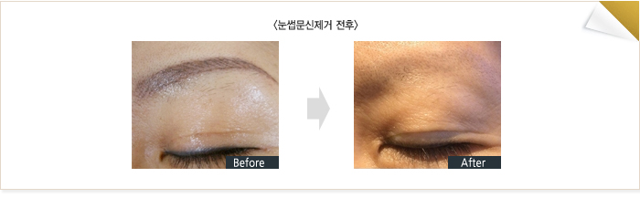 �ü�����