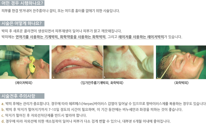 � ��� �����ϳ���?/�ü��� ��� �ϳ���? /�ü����� ���ǻ���