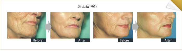 �ü�����