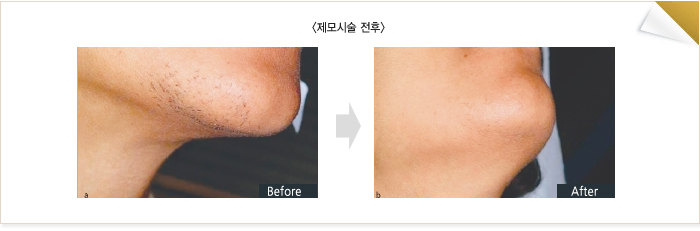 �ü�����