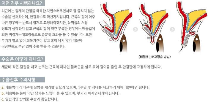 ���������ű��������