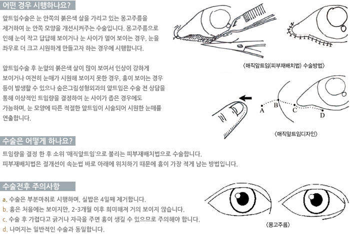 ��Ʈ�Ӽ������-� ��� �����ϳ���?