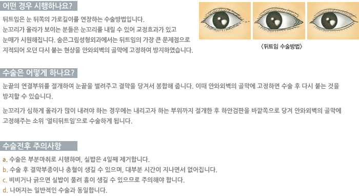 ��Ʈ�Ӽ������-� ��� �����ϳ���?