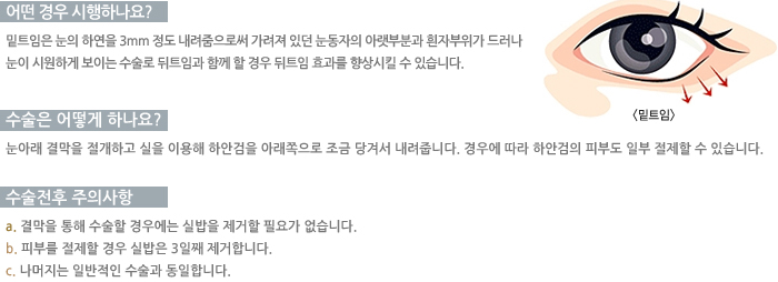 ��Ʈ�Ӽ������-� ��� �����ϳ���?