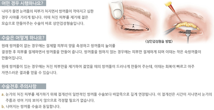 ��Ȱ˼��������-� ��� �����ϳ���?