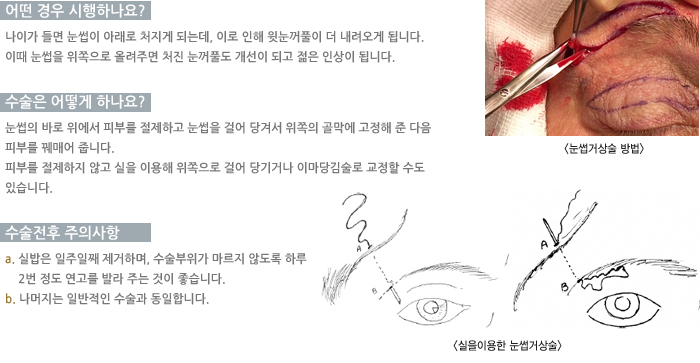 ����Ż����-� ��� �����ϳ���?