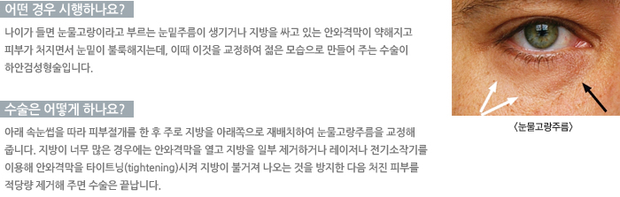 �ϾȰ˼��������-� ��� �����ϳ���?