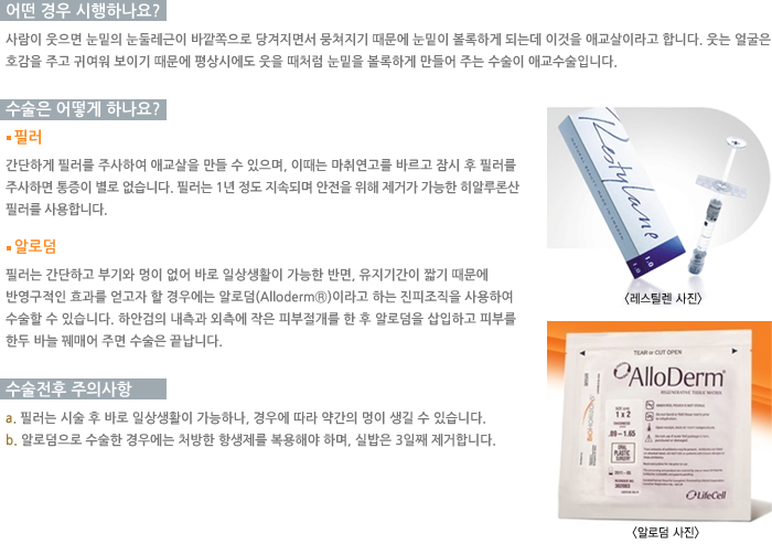 ���ؾֱ��ü���-� ��� �����ϳ���?