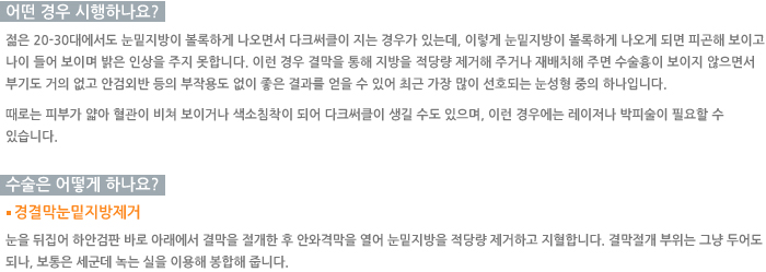 ����������-� ��� �����ϳ���?