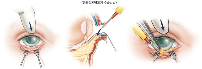 ��ḷ�������� �������