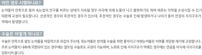 �Ȱ˳��ݹ��-� ��� �����ϳ���?, ������ ��� �ϳ���?