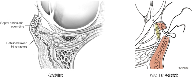 �Ȱ˳���, �Ȱ˳��ݼ������