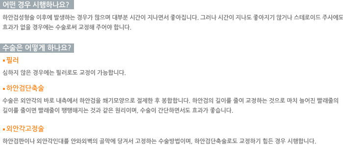 ���ؾֱ��ü���-� ��� �����ϳ���?, ������ ��� �ϳ���?