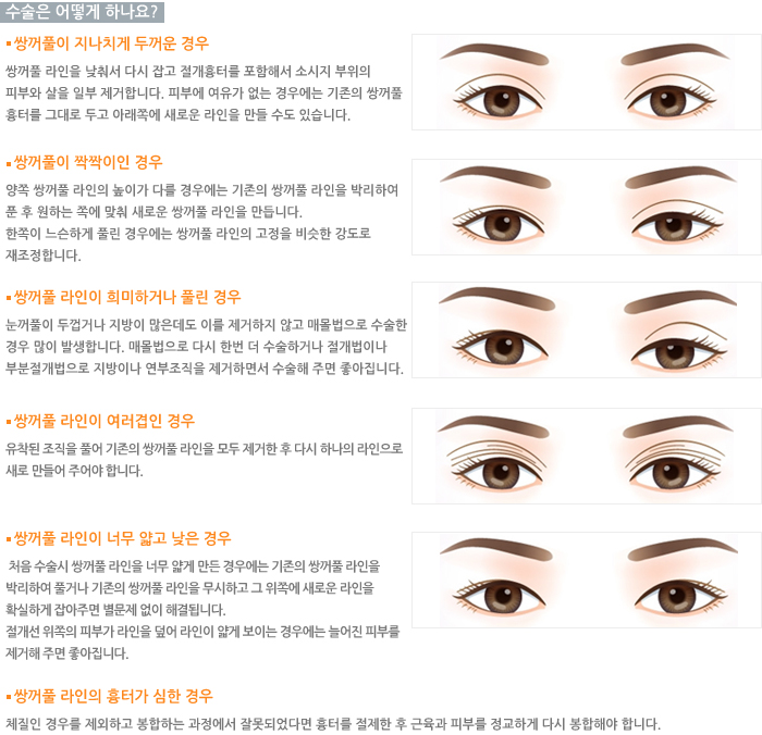 ������ ��� �ϳ���?