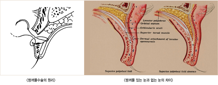 �ֲ�Ǯ������ ���� / �ֲ�Ǯ�ִ� ���� ���� ���� ����