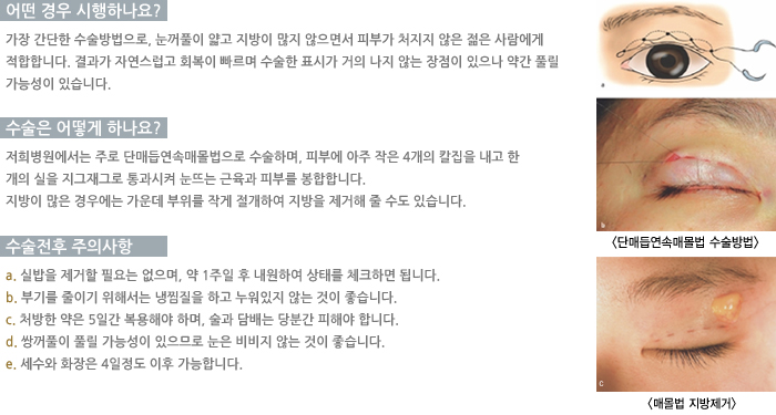 � ��� �����ϳ���?