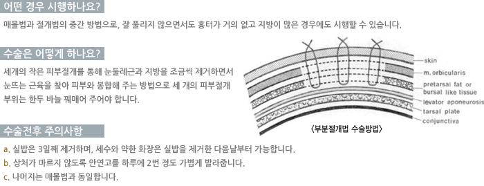 � ��� �����ϳ���?