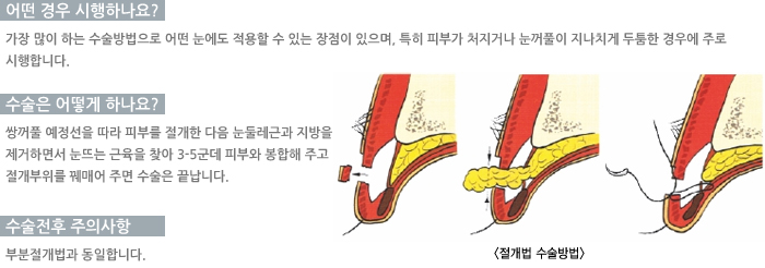 � ��� �����ϳ���?