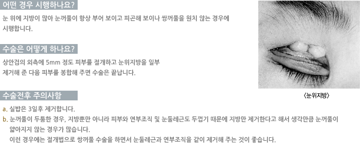 � ��� �����ϳ���?