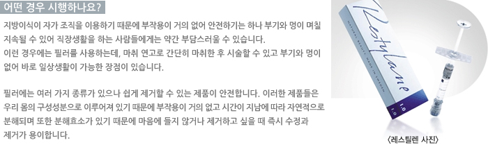 � ��� �����ϳ���?