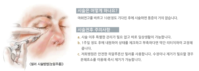 �ü��� ��� �ϳ���? / �ü����� ���ǻ���